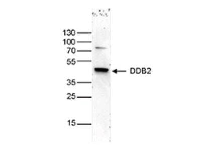 Western Blot: XPE/DDB2 Antibody (C.15200222) [NBP2-62792]