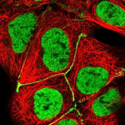 Immunocytochemistry/ Immunofluorescence: XPE/DDB2 Antibody [NBP2-38854]