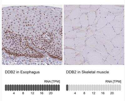 Immunohistochemistry-Paraffin: XPE/DDB2 Antibody [NBP2-38854]