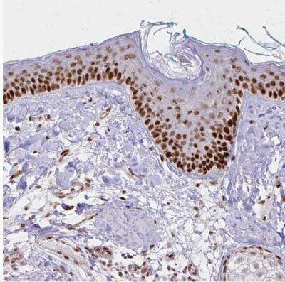 Immunohistochemistry-Paraffin: XPE/DDB2 Antibody [NBP2-38854]