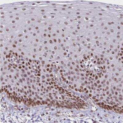 Immunohistochemistry-Paraffin: XPE/DDB2 Antibody [NBP2-38854]