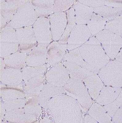 Immunohistochemistry-Paraffin: XPE/DDB2 Antibody [NBP2-38854]
