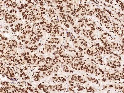 Immunohistochemistry-Paraffin: XPE/DDB2 Antibody [NBP2-98940]