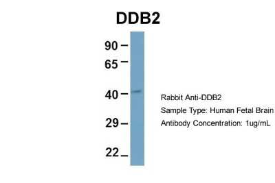 Western Blot: XPE/DDB2 Antibody [NBP1-68879]