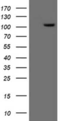 Western Blot: XPF Antibody (OTI3H7) [NBP2-45503]