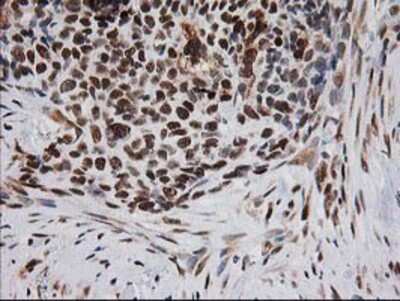 Immunohistochemistry-Paraffin: XPF Antibody (OTI4E11) [NBP2-01020]