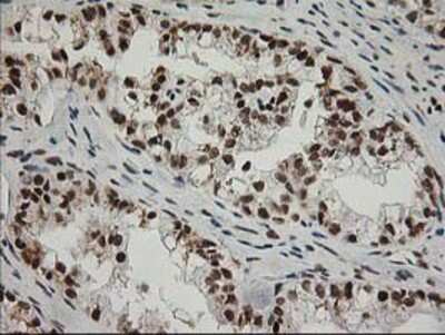 Immunohistochemistry-Paraffin: XPF Antibody (OTI4E11) [NBP2-01020]