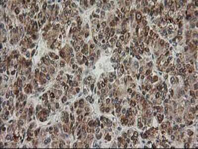 Immunohistochemistry-Paraffin: XPF Antibody (OTI4E11) [NBP2-01020]