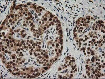 Immunohistochemistry-Paraffin: XPF Antibody (OTI4E11) [NBP2-01020]