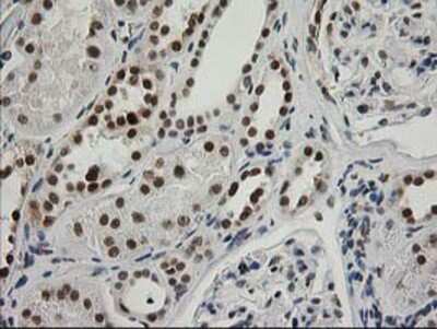 Immunohistochemistry-Paraffin: XPF Antibody (OTI4E11) [NBP2-01020]