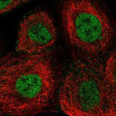 Immunocytochemistry/ Immunofluorescence: XPF Antibody [NBP2-58407]