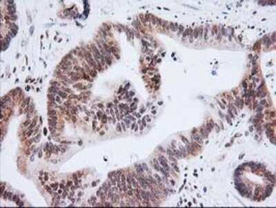 Immunohistochemistry: XPF Antibody (OTI4E11) - Azide and BSA Free [NBP2-74883]