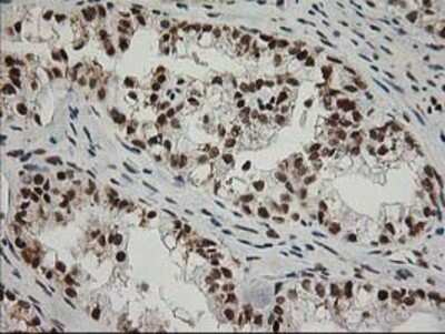 Immunohistochemistry: XPF Antibody (OTI4E11) - Azide and BSA Free [NBP2-74883]