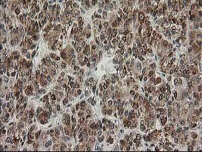 Immunohistochemistry: XPF Antibody (OTI4E11) - Azide and BSA Free [NBP2-74883]