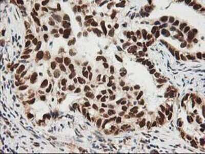Immunohistochemistry: XPF Antibody (OTI4E11) - Azide and BSA Free [NBP2-74883]