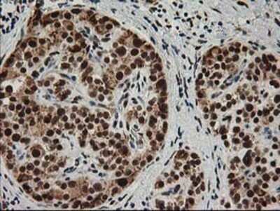 Immunohistochemistry: XPF Antibody (OTI4E11) - Azide and BSA Free [NBP2-74883]
