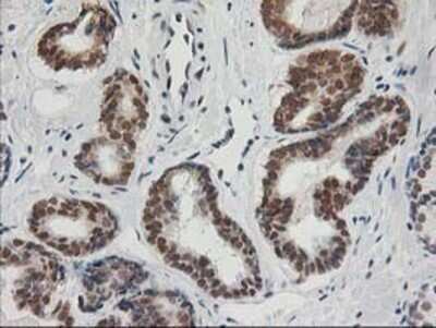Immunohistochemistry: XPF Antibody (OTI4E11) - Azide and BSA Free [NBP2-74883]
