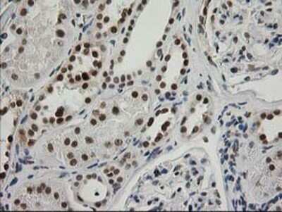 Immunohistochemistry: XPF Antibody (OTI4E11) - Azide and BSA Free [NBP2-74883]