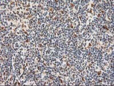 Immunohistochemistry: XPF Antibody (OTI4E11) - Azide and BSA Free [NBP2-74883]