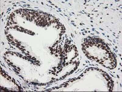Immunohistochemistry: XPF Antibody (OTI4E11) - Azide and BSA Free [NBP2-74883]