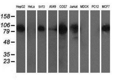Western Blot: XPF Antibody (OTI4E11)Azide and BSA Free [NBP2-74883]