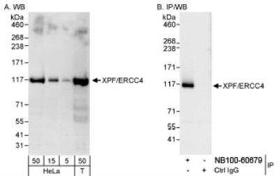 Western Blot: XPF Antibody [NB100-60679]