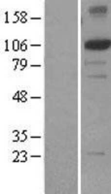 Western Blot: XPF Overexpression Lysate [NBL1-10322]