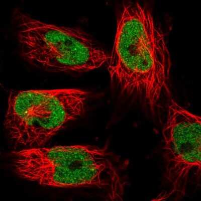 Immunocytochemistry/ Immunofluorescence: XPG Antibody [NBP2-47578]