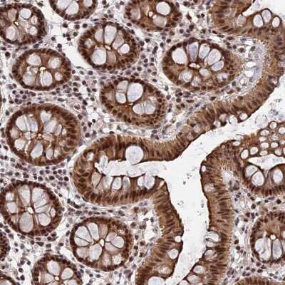 Immunohistochemistry-Paraffin: XPG Antibody [NBP2-47577]
