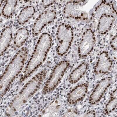 Immunohistochemistry-Paraffin: XPG Antibody [NBP2-47578]