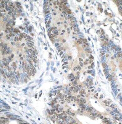 Immunohistochemistry-Paraffin: XPG Antibody [NB100-74611]