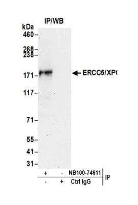 Immunoprecipitation: XPG Antibody [NB100-74611]