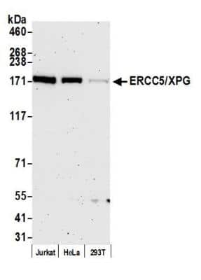 Western Blot: XPG Antibody [NB100-74611]