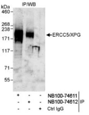 Immunoprecipitation: XPG Antibody [NB100-74612]