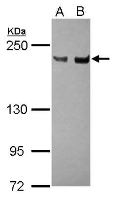 Western Blot: XPG Antibody [NBP2-20924]