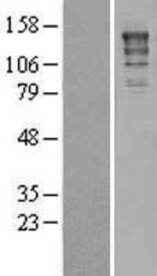 Western Blot: XPG Overexpression Lysate [NBL1-10323]