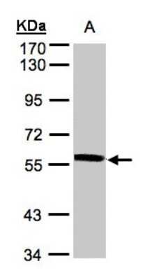 Western Blot: XPNPEP3 Antibody [NBP1-31556]