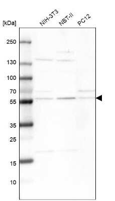 Western Blot: XPNPEP3 Antibody [NBP1-89030]