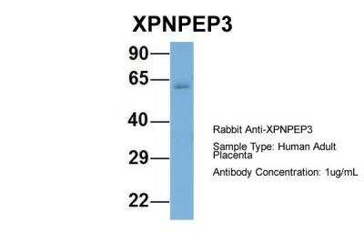 Western Blot: XPNPEP3 Antibody [NBP2-86390]