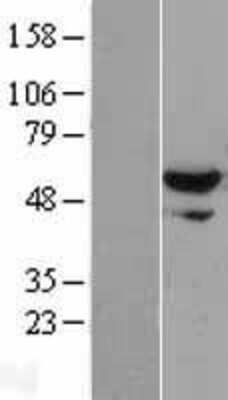 Western Blot: XPNPEP3 Overexpression Lysate [NBL1-17910]