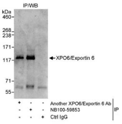 Immunoprecipitation: XPO6 Antibody [NB100-59853]