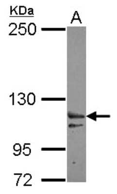 Western Blot: XPO6 Antibody [NBP2-20925]