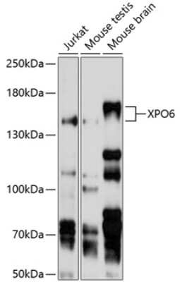 Western Blot: XPO6 AntibodyBSA Free [NBP2-93480]