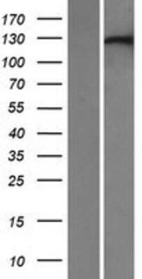 Western Blot: XPO6 Overexpression Lysate [NBP2-07210]