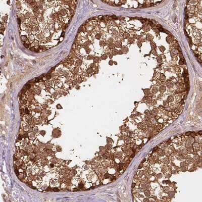 Immunohistochemistry-Paraffin: XPR1 Antibody [NBP2-48531]