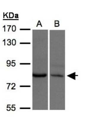 Western Blot: XPR1 Antibody [NBP1-31083]