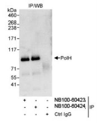 Immunoprecipitation: XPV/DNA polymerase eta Antibody [NB100-60423]