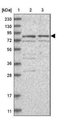 Western Blot: XPV/DNA polymerase eta Antibody [NBP1-87166]