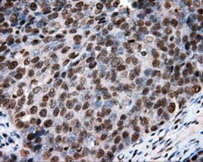 Immunohistochemistry-Paraffin: XRCC1 Antibody (OTI2F8) [NBP2-02280]