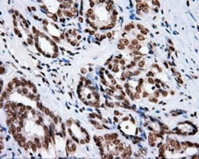 Immunohistochemistry-Paraffin: XRCC1 Antibody (OTI2F8) [NBP2-02280]